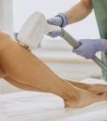 Laser Progressively Definitive Hair Removal – Arms (Women)