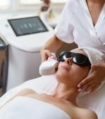 Laser Progressively Definitive Hair Removal – Face (Women)